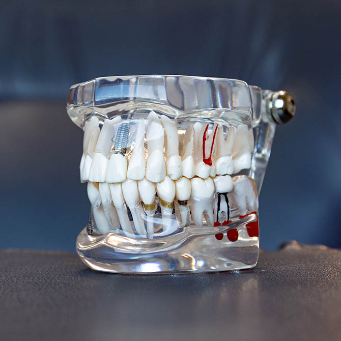 Keep a Healthy Smile With General & Preventive Dentistry in Colorado Springs