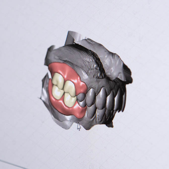 Repair Your Oral Function With a Restorative Dentist in Colorado Springs
